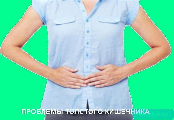 alt="Колит кишечника"
